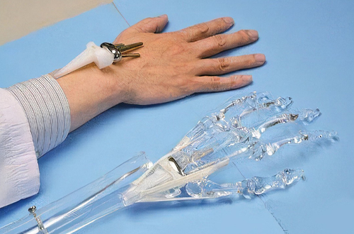 人工關(guān)節(jié) 1.jpg